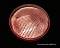 corynebacterium diphtheriae